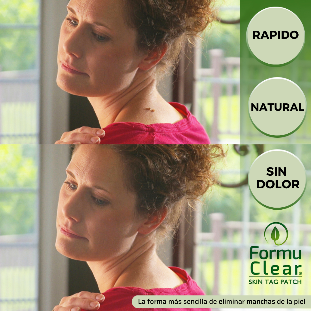 Formu Clear Skin Tag
