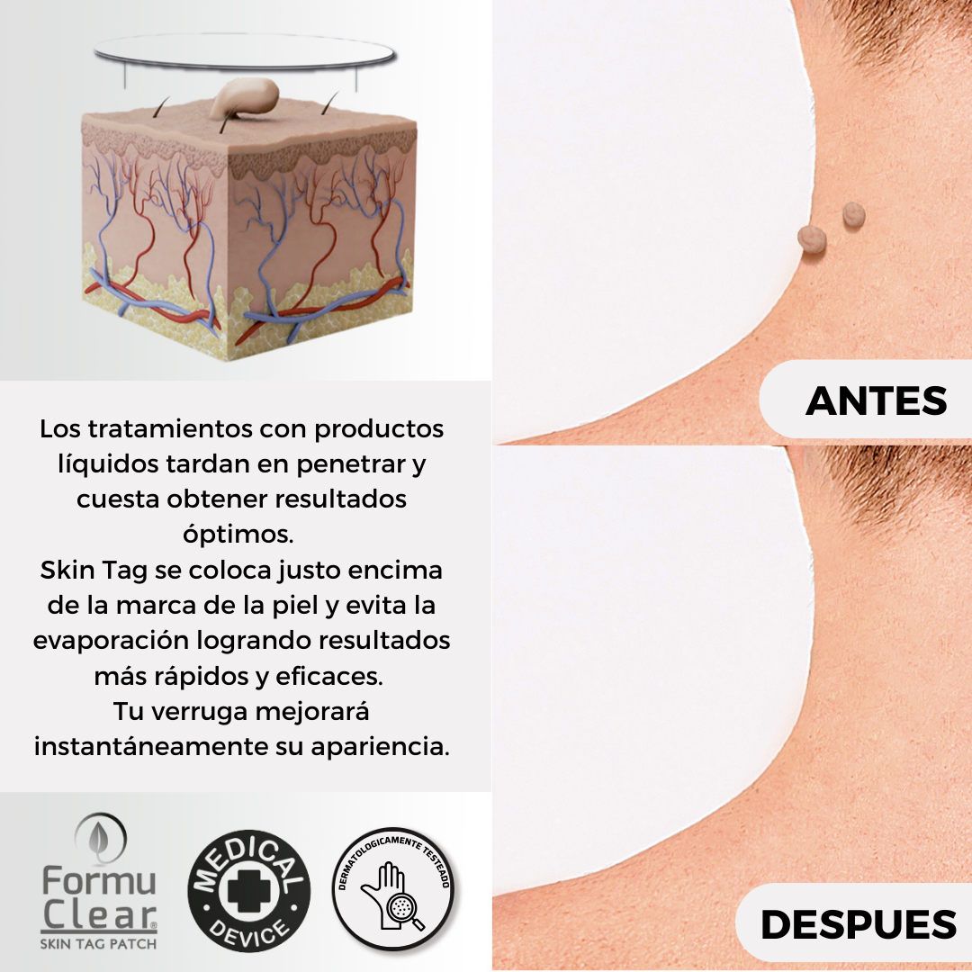 Formu Clear Skin Tag